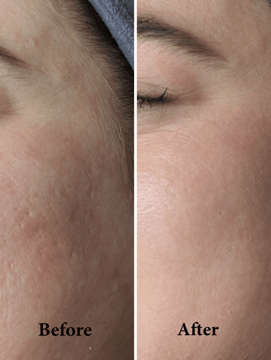 20% VITAMIN C SERUM 30ML - Image 5